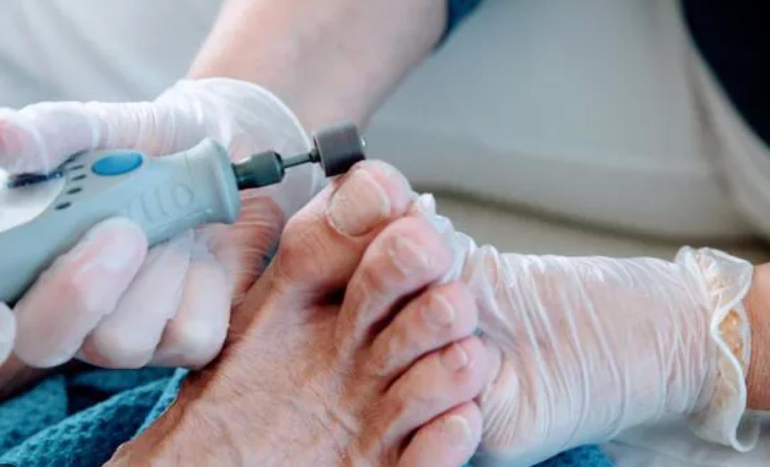 Nurse Your Nails