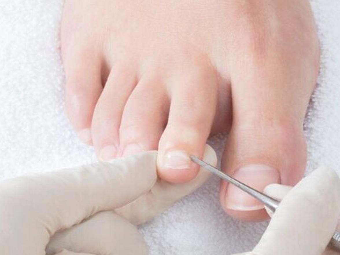 Nurse Your Nails